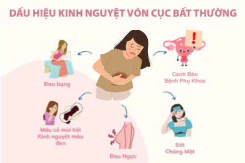 Phụ nữ đến kỳ kinh nguyệt bị vón cục có sao không?