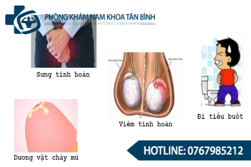  Top 3 địa chỉ phòng khám nam khoa uy tín tại Hưng Yên