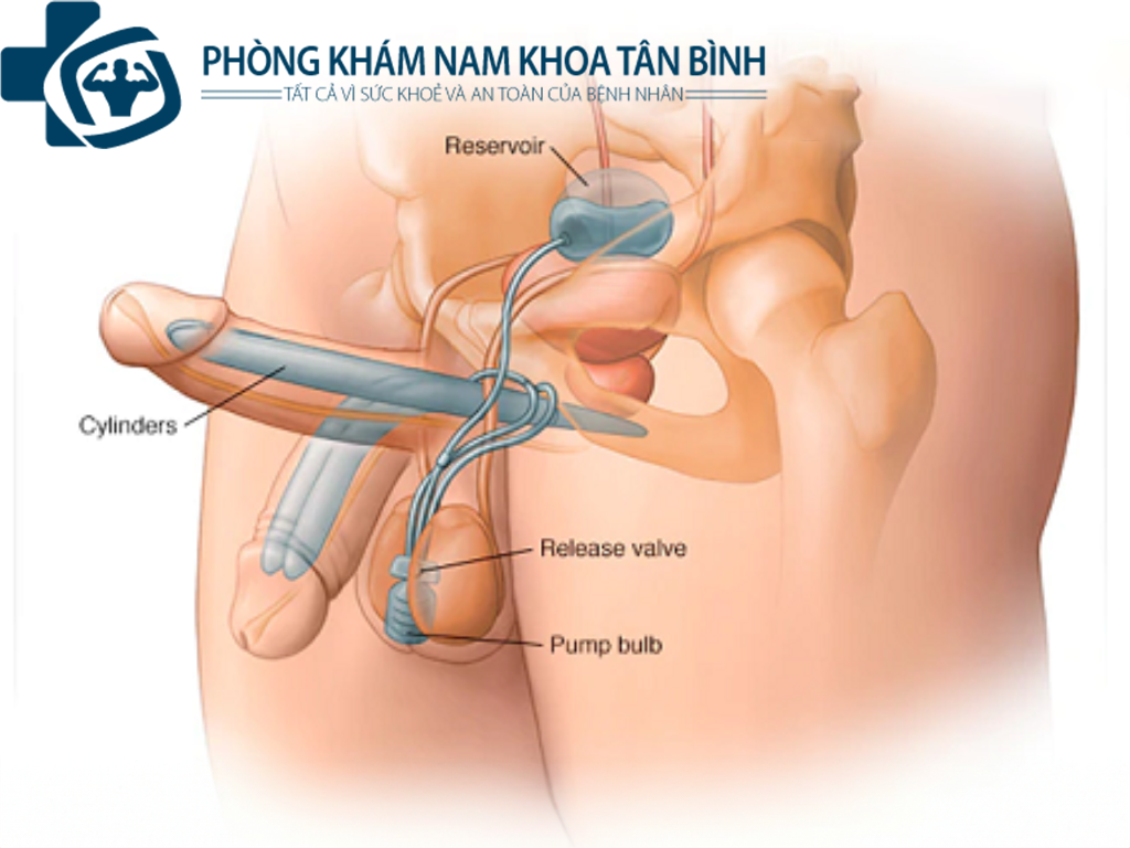  Dương vật không cương cứng phải làm sao? cách khắc phục