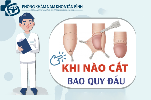  Khi nào cần phải cắt bao quy đầu ở nam giới?