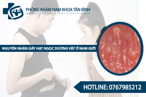  Nguyên nhân gây hạt ngọc dương vật ở nam giới